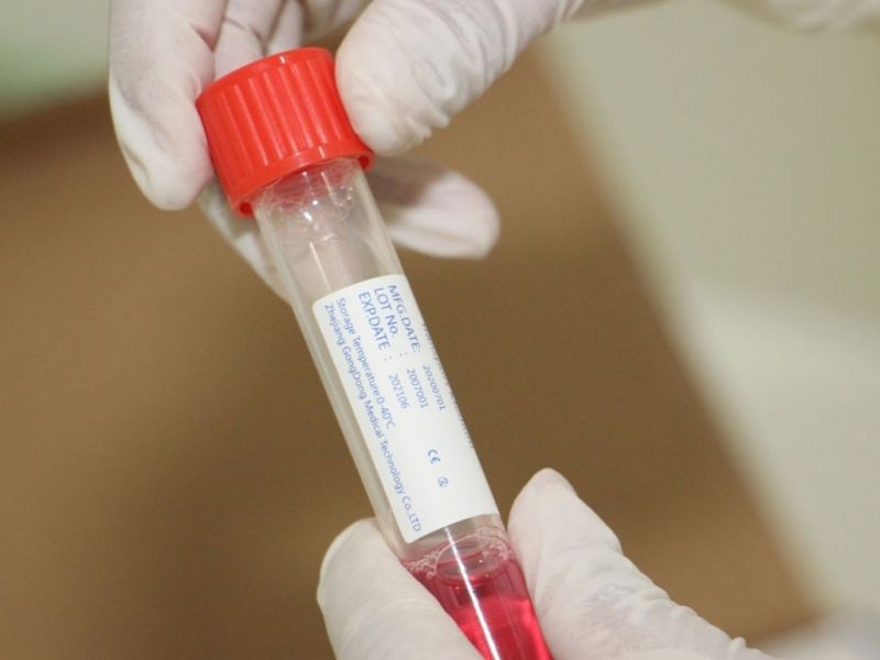 За прошедшие сутки в Казахстане 397 человек выздоровели от коронавирусной инфекции
