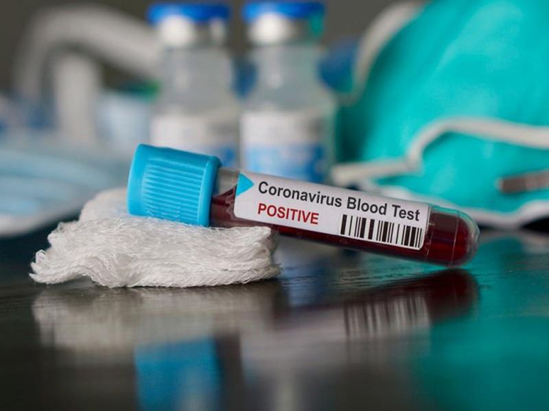 Переболевшим коронавирусом не стоит откладывать вакцинацию