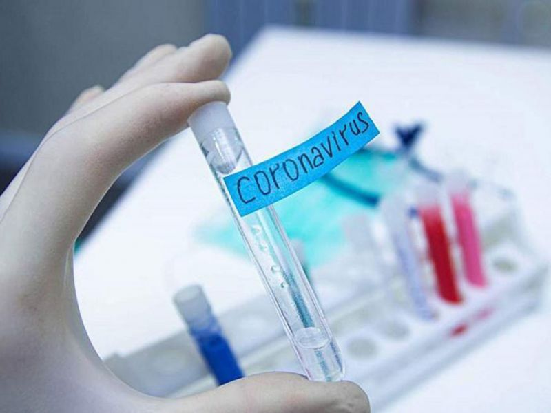 Лечение от коронавируса в Казахстане продолжают получать 22456 человек