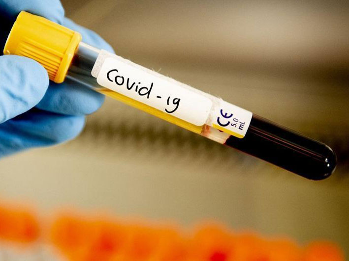 За прошедшие сутки в Казахстане 11 человек выздоровели от коронавирусной инфекции