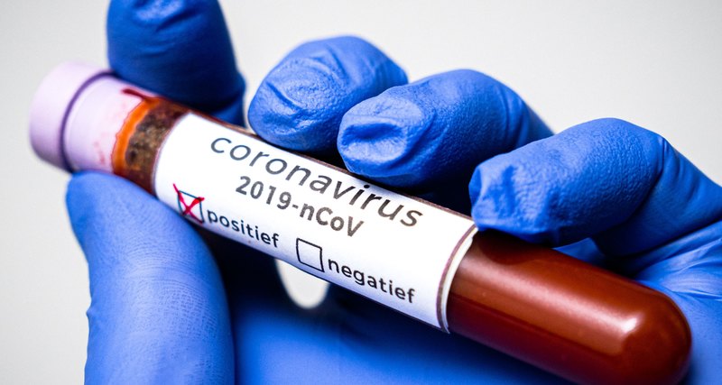 Об эпидемиологической ситуации по коронавирусу на 23:59 час. 24 июня 2020 г. в Казахстане