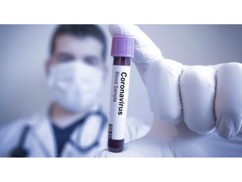 За прошедшие сутки в Казахстане 272 человека выздоровели от коронавирусной инфекции