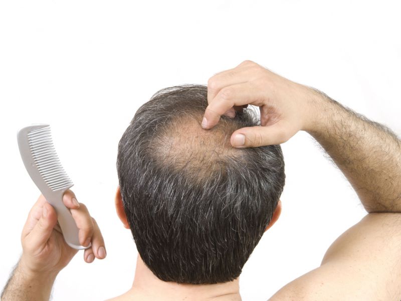 Хорошая новость о восстановлении волос
