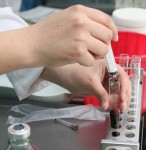 Внимание: листериоз – особо опасная инфекция!