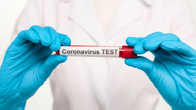 Еще 138 случаев коронавируса зарегистрировано в Казахстане